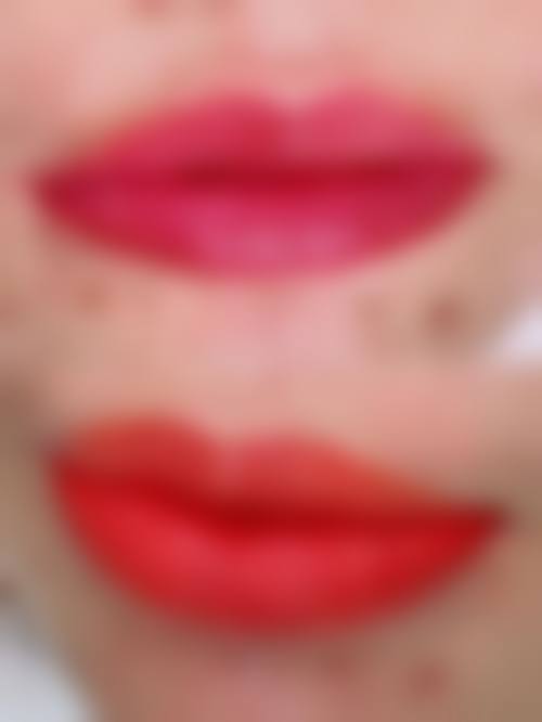 七、深圳千羽医院疤痕整形科价格表：（仅供参考）