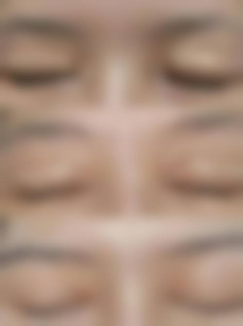 五、长沙中南大学湘雅三医院整形美容科实例