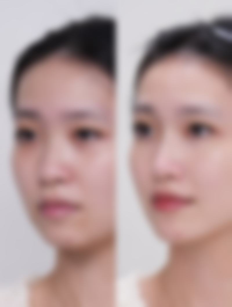 八、长春华怡医疗美容诊所真实的顾客评价如下：