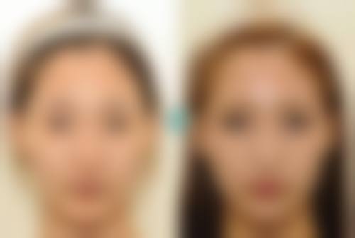 五、青岛万姿医疗美容诊所怎么预约：