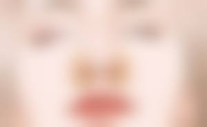 额头缝针疤痕如何祛除？手术治疗除顽疾