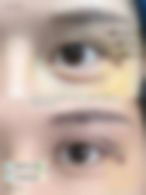 八、成都绿叶爱丽美妇产科医院医疗整形美容科真实的顾客评价如下：