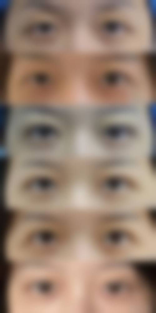 禹恩镜医生口碑和评价