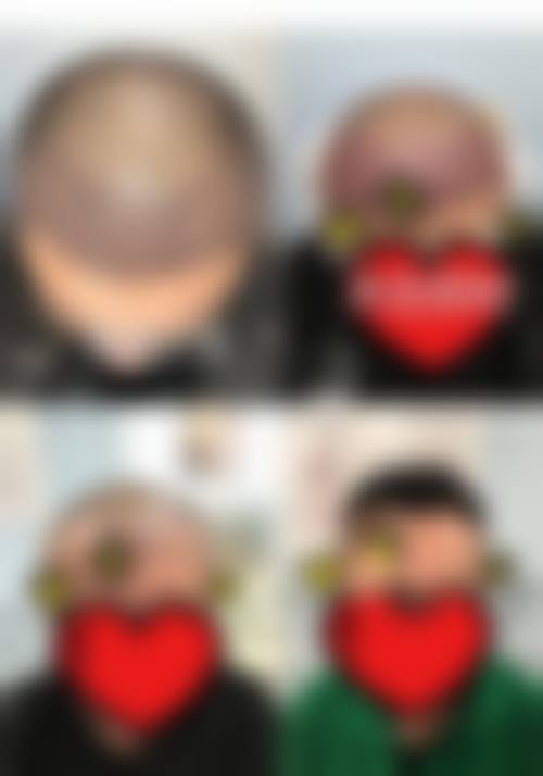 五、濮阳华壹姿整形医疗美容诊所实例