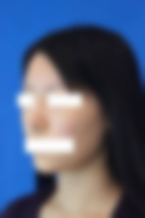 七、合肥亚典美容医院价格表：（仅供参考）