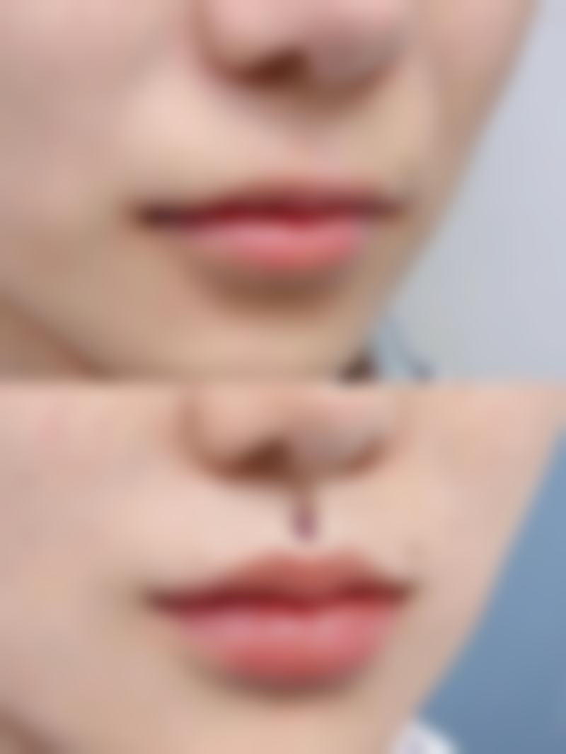 五、晋城现代妇产医院整形科实例