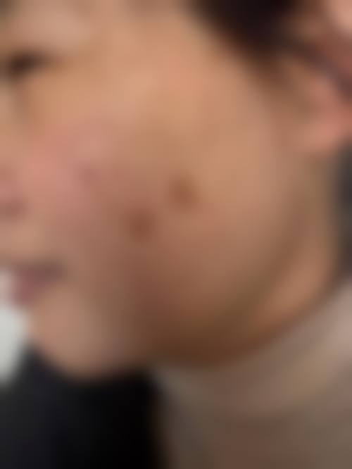 七、宁波皮肤病专科医院价格表：（仅供参考）