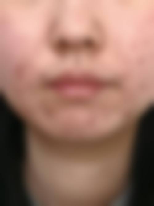 五、宁波皮肤病专科医院实例