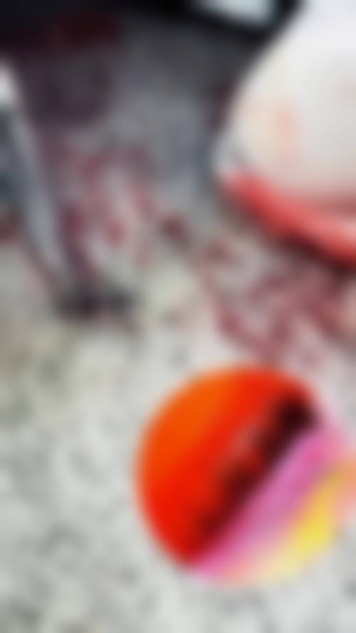 宋振宁医生毛发移植怎么样可靠吗？