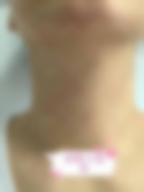 八、南京缪斯女神医疗美容诊所真实的顾客评价如下：