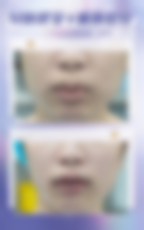 六、贵港俊泰整形医院怎么预约：