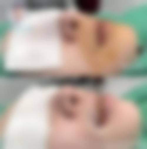 五、贵港俊泰整形医院实例