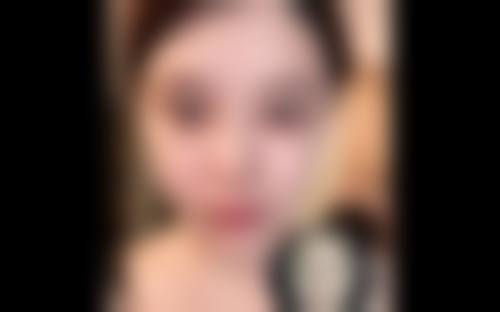 五、长沙美研整形医院实例