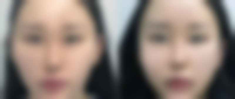 六、广西河池中清铂雅整形医院怎么预约：