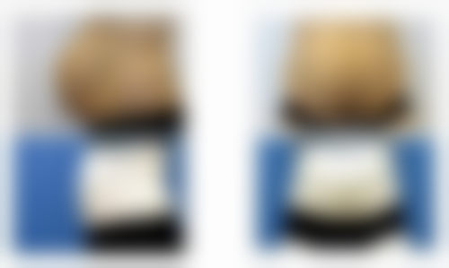 韩国首尔slim整形医院