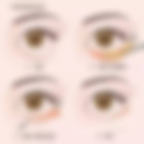 李舒倩医生眼部整形项目价格表参考