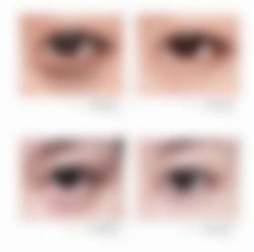 李舒倩医生眼部整形怎么样可靠吗？