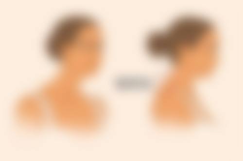 祛痣疤痕修复时间大揭秘！术后护理怎样促进疤痕修复？