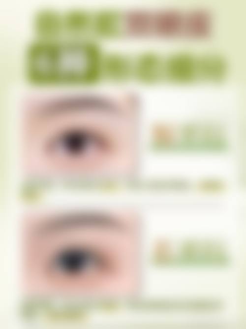 五、惠州亨川整形医院实例