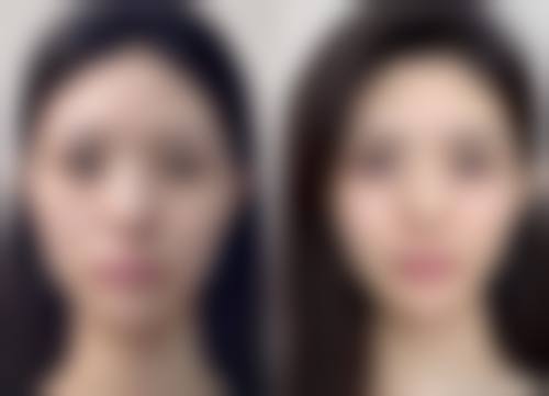 胡瑾医生面部美容项目价格表参考