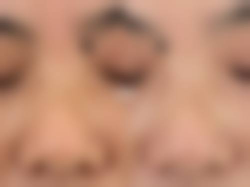 七、乌鲁木齐子桐医疗美容诊所价格表：（仅供参考）