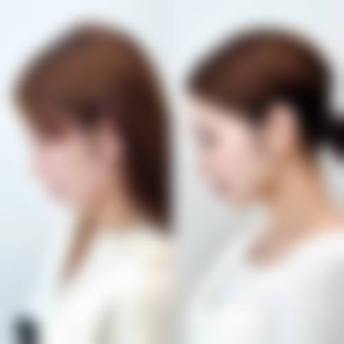 胡瑾医生怎么预约？