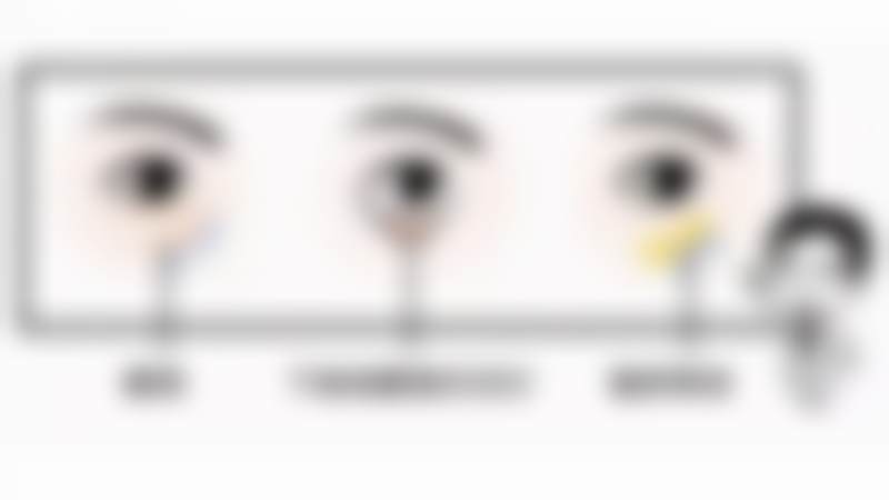 韩国可来熙整形外科