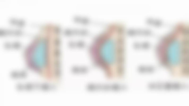 五、韩国可来熙整形外科实例