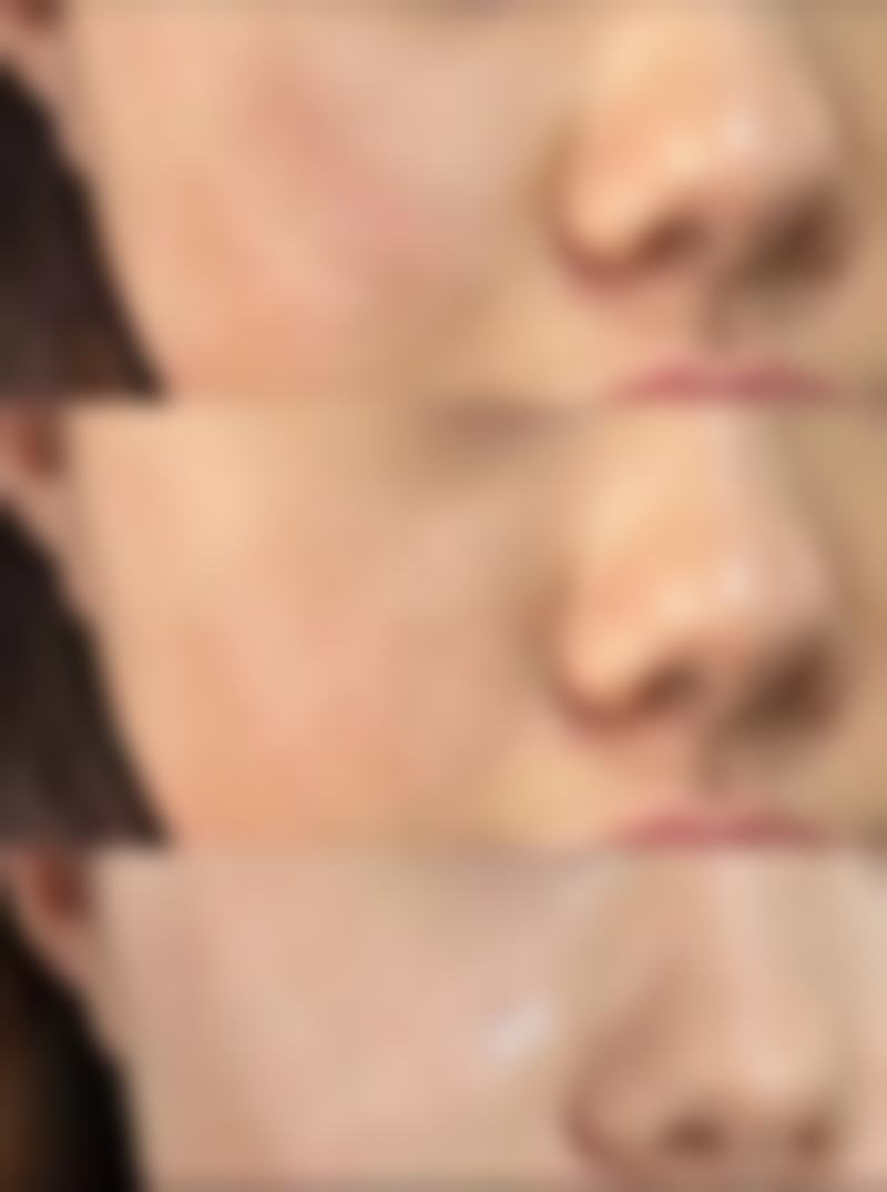 假体隆胸究竟能否喂奶？权威解析不同假体特性及保障哺乳安全的秘诀 