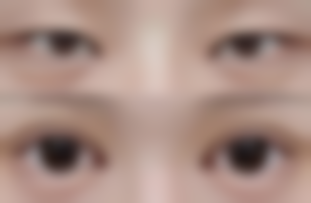 四、烟台桦晓整形医院实例