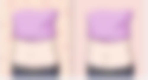 五、汕头曙光整形美容门诊部实例