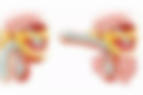 超体隆鼻的价格情况