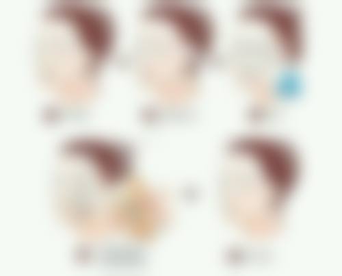 超体隆鼻术后护理要点