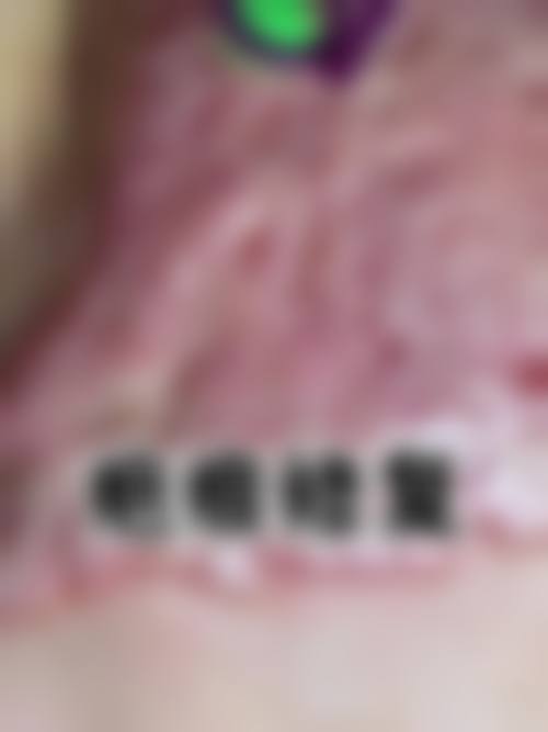 八、泉州中科医院真实的顾客评价如下: