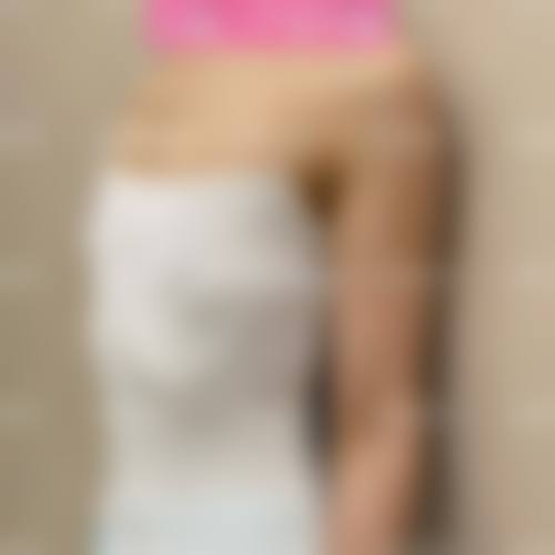 六、汕头曙光整形美容门诊部怎么预约：