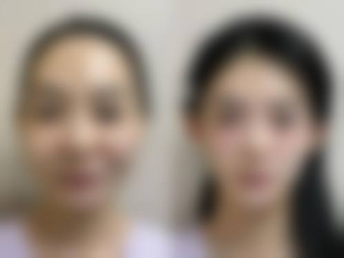 八、汕头曙光整形美容门诊部真实的顾客评价如下：