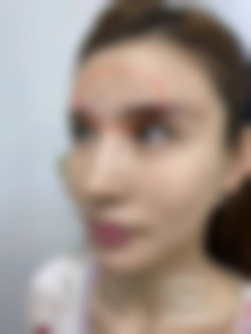 五、武汉美善美医疗美容医院实例