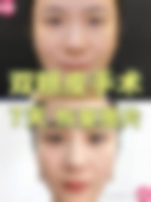 二、梅州皇佳贝丽医学美容门诊部正规吗？来看看医院资质：