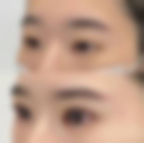 六、梅州皇佳贝丽医学美容门诊部怎么预约：