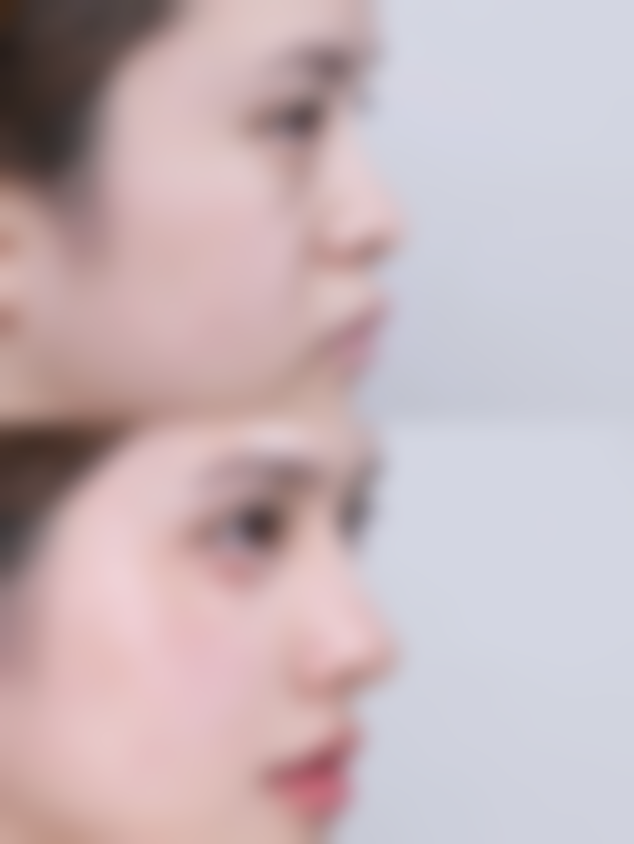 疤痕膏对手术疤痕真的有用吗？揭秘不同手术适用情况及使用注意要点 