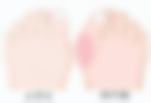 手术费用区间：不同手术类型和情况大不同