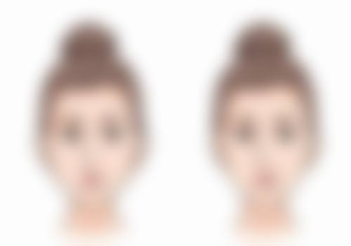 宫腹腔镜手术时长：因人而异的具体情况