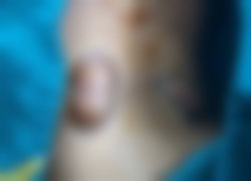 七、哈尔滨市第五医院价格表:(仅供参考)