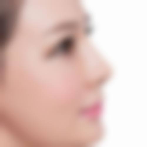 五、扬州和平医院整形美容科实例