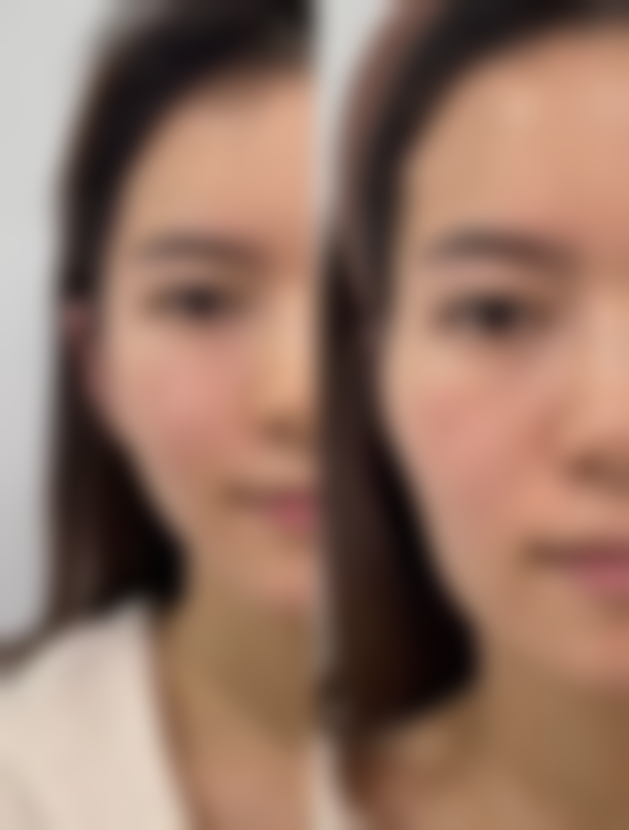 七、广州全芯医疗美容门诊部价格表：（仅供参考）