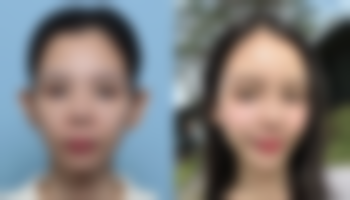 六、上海馨美医疗美容门诊部怎么预约: