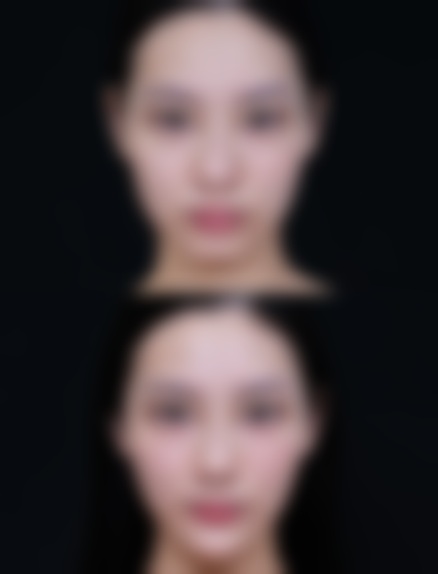 六、扬州和平医院整形美容科怎么预约：