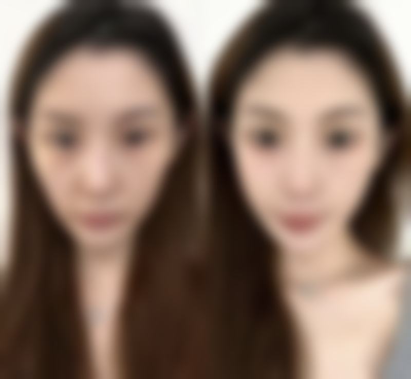 六、南京百筑整形医院怎么预约: