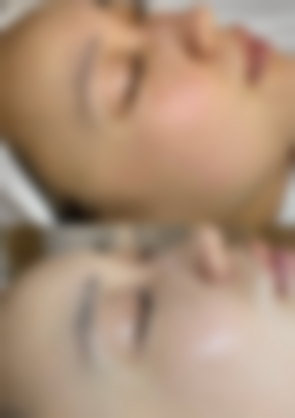 五、南京百筑整形医院实例