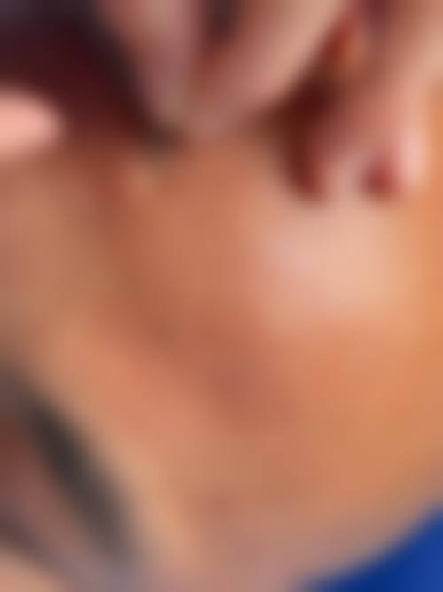 陈怡皆医生怎么预约？